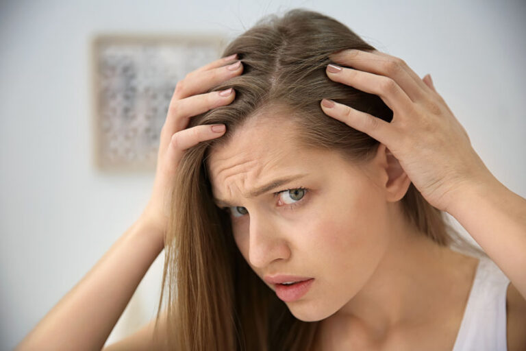 Hair Loss In Women And Men Treatment You Need Know