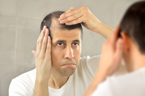 The best hair loss treatment Related Information You Should know